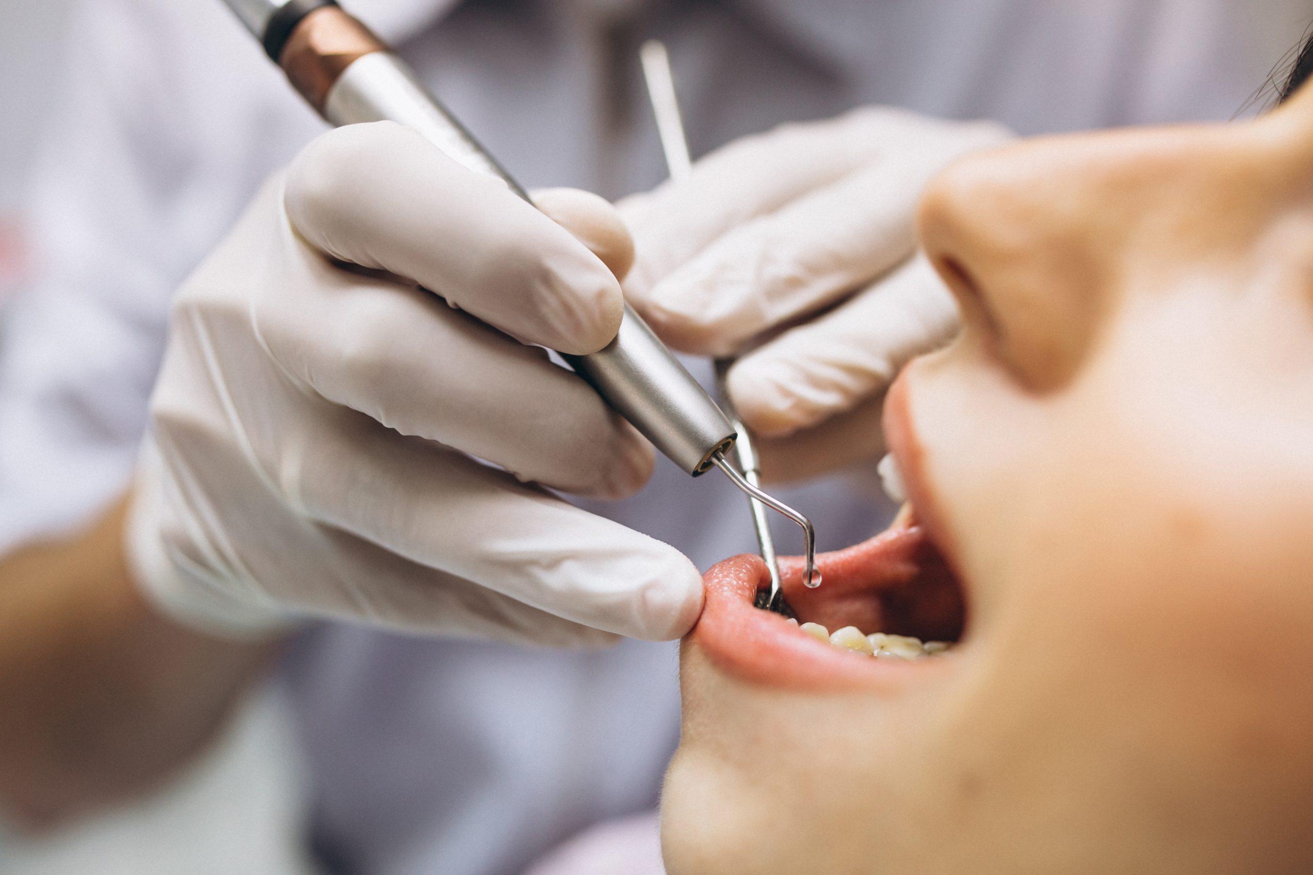 5 razloga zašto imamo strah od zubara –  i kako ga se riješiti